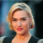 Celebrities with Bulbous Nose